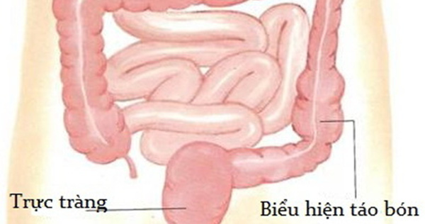 Những nguy hiểm khôn lường khi bị táo bón lâu ngày mà bạn không ngờ tới